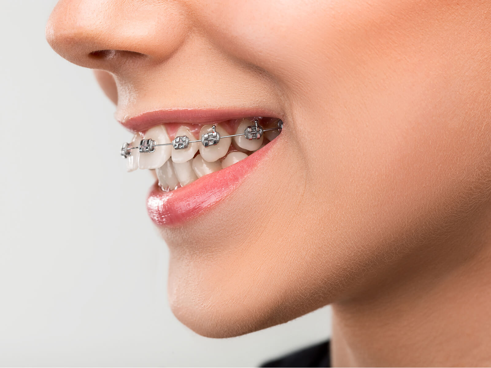 The Consequences of Ignoring Orthodontic Problems