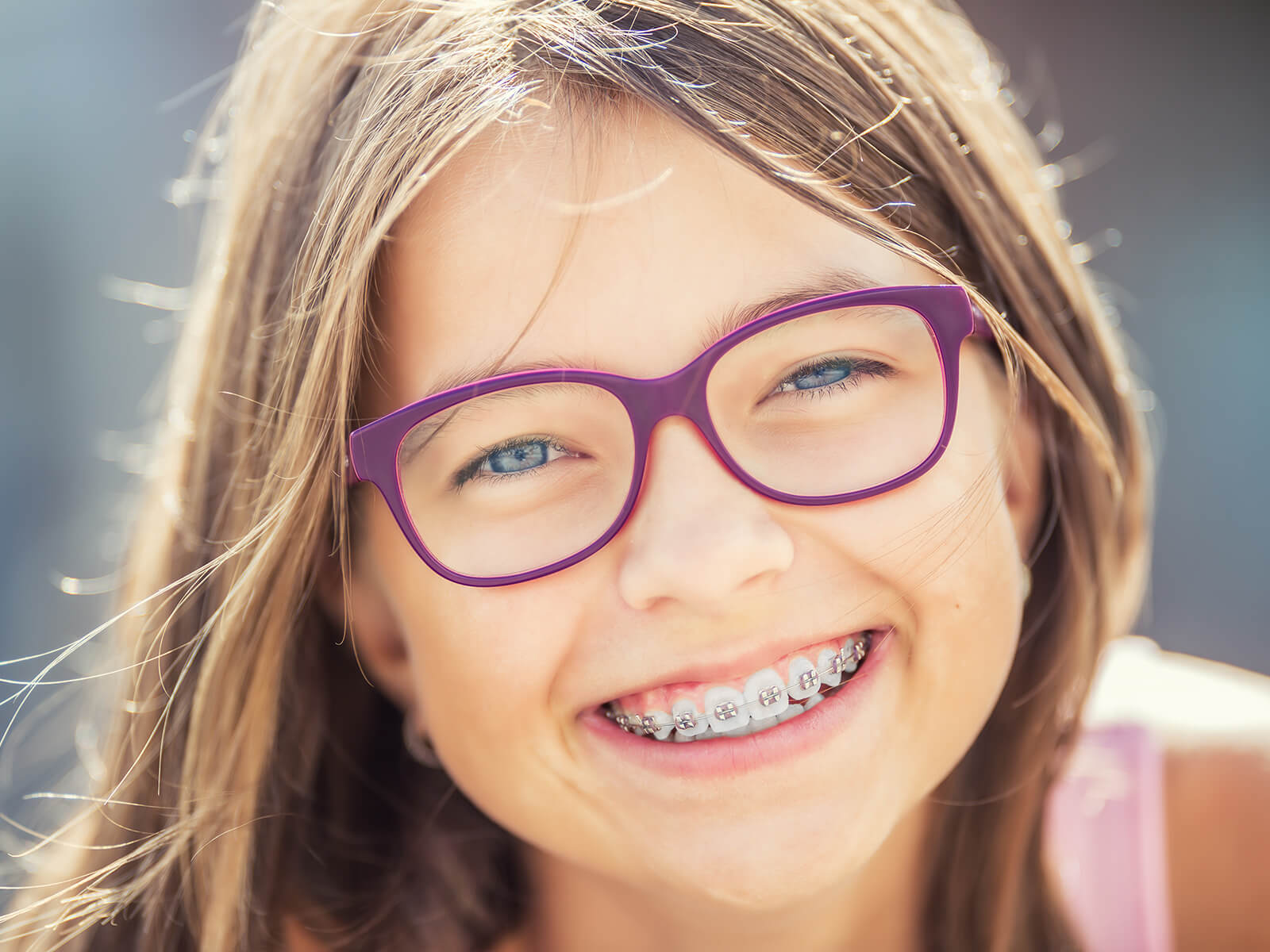 Braces For Kids: Everything You Should Know As A Parent