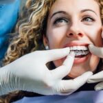 Can I Get Invisalign If I Have a Dental Implant?